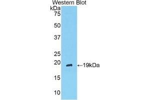 Detection of Recombinant ANGPT1, Rat using Polyclonal Antibody to Angiopoietin 1 (ANGPT1) (Angiopoietin 1 抗体  (AA 304-450))
