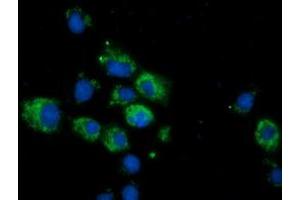 Immunofluorescence (IF) image for anti-Calcium Binding and Coiled-Coil Domain 2 (CALCOCO2) antibody (ABIN1497075) (CALCOCO2 抗体)