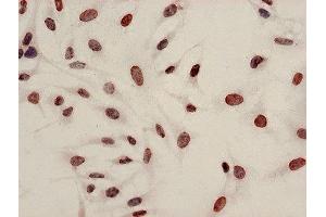 Immunocytochemistry analysis of Hela cells using ABIN7139199 at dilution of 1:100 (HIST1H4A 抗体  (acLys8))