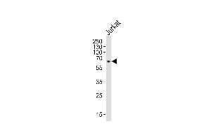 Western blot analysis of lysate from Jurkat cell line, using IL2RG Antibody (N-term) (ABIN653403 and ABIN2842858). (IL2RG 抗体  (N-Term))