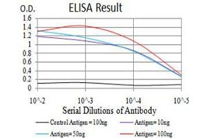 Black line: Control Antigen (100 ng),Purple line: Antigen (10 ng), Blue line: Antigen (50 ng), Red line:Antigen (100 ng) (KDM6A 抗体  (AA 1252-1401))