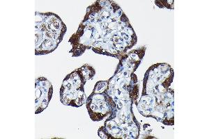 Immunohistochemistry (IHC) image for anti-Paternally Expressed 10 (PEG10) (AA 1-325) antibody (ABIN1681320)