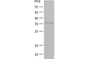 Western Blotting (WB) image for Guanosine Monophosphate Reductase (GMPR) (AA 1-345) protein (His tag) (ABIN7286054) (GMPR Protein (AA 1-345) (His tag))