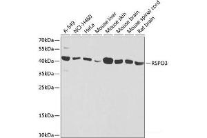 Western blot analysis of extracts of various cell lines using RSPO3 Polyclonal Antibody at dilution of 1:1000. (R-Spondin 3 抗体)