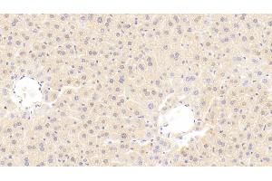 Detection of MMP3 in Mouse Liver Tissue using Polyclonal Antibody to Matrix Metalloproteinase 3 (MMP3) (MMP3 抗体  (AA 100-477))