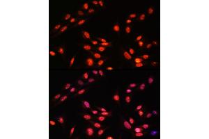 Immunofluorescence analysis of Rat colon using CTSC antibody (ABIN7267936) at dilution of 1:100 (40x lens). (ESRRA 抗体  (AA 1-423))