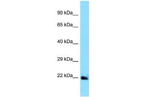 WB Suggested Anti-EFNA5 Antibody Titration: 1. (Ephrin A5 抗体  (Middle Region))