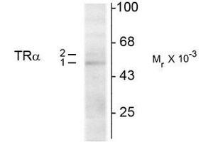 Western Blotting (WB) image for anti-Thyroid Hormone Receptor, alpha (THRA) (N-Term) antibody (ABIN371844) (THRA 抗体  (N-Term))