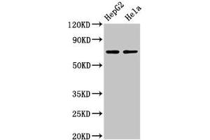 Western Blot Positive WB detected in: HepG2 whole cell lysate, Hela whole cell lysate All lanes: AMFR antibody at 4 μg/mL Secondary Goat polyclonal to rabbit IgG at 1/50000 dilution Predicted band size: 73 kDa Observed band size: 73 kDa (AMFR 抗体  (AA 485-643))