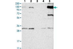Western blot analysis of Lane 1: RT-4, Lane 2: U-251 MG, Lane 3: Human Plasma, Lane 4: Liver, Lane 5: Tonsil with ANKRD35 polyclonal antibody . (ANKRD35 抗体)