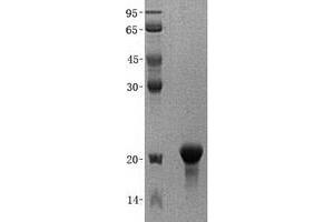 Validation with Western Blot (PFDN2 Protein (His tag))