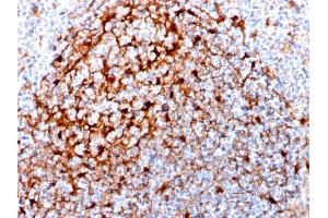 Immunohistochemistry (IHC) image for anti-Cystatin A (Stefin A) (CSTA) antibody (ABIN6939196)