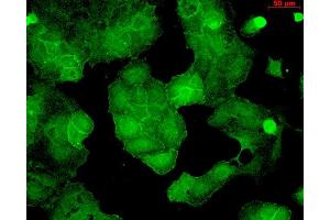 Immunocytochemistry/Immunofluorescence analysis using Mouse Anti-PSD95 Monoclonal Antibody, Clone 6G6 . (DLG4 抗体  (APC))