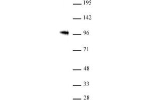 SOX6 antibody (pAb) tested by Western blot.