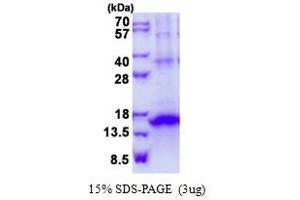 KLRG1 Protein (His tag)