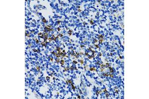 Immunohistochemistry of paraffin-embedded human tonsil using STAT3 antibody (ABIN5998978) at dilution of 1/100 (40x lens). (STAT3 抗体)