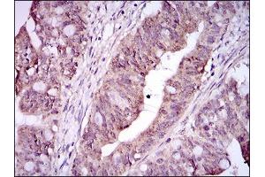 Flow Cytometry (FACS) image for anti-Integrin Alpha2b (CD41) (AA 45-149) antibody (ABIN1844101)