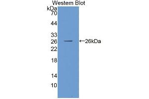 Western blot analysis of the recombinant protein. (MPP3 抗体  (AA 627-802))