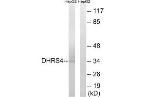 Western blot analysis of extracts from HepG2 cells, using DHRS4 antibody. (DHRS4 抗体  (C-Term))