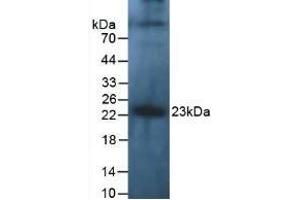 Detection of IL10 in Human Leukocyte Cells using Polyclonal Antibody to Interleukin 10 (IL10) (IL-10 抗体  (AA 1-178))