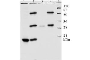 Lane 1 shows detection of E7 protein by Mab 8G6 in lysate of U20S cells. (Human Papilloma Virus 11 E7 (HPV-11 E7) (AA 1-35) 抗体)