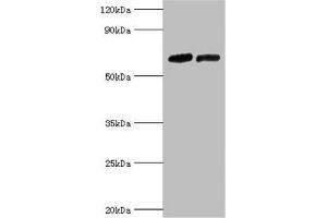 Western blot All lanes: Nuclear receptor subfamily 2 group C member 1 antibody at 10 μg/mL Lane 1: PC-3 whole cell lysate Lane 2: 293T whole cell lysate Secondary Goat polyclonal to rabbit IgG at 1/10000 dilution Predicted band size: 68, 52, 54 kDa Observed band size: 68 kDa (NR2C1 抗体  (AA 1-240))