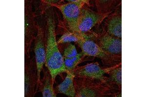 Immunofluorescence analysis of U251 cells using NFKB1 mouse mAb (green).