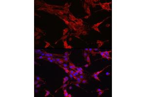 Immunofluorescence (IF) image for anti-Signal Transducer and Activator of Transcription 6, Interleukin-4 Induced (STAT6) (AA 1-180) antibody (ABIN6148581)