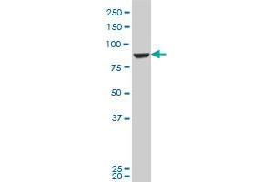 GPHN polyclonal antibody (A01), Lot # 060118JC01 Western Blot analysis of GPHN expression in Jurkat . (Gephyrin 抗体  (AA 677-769))