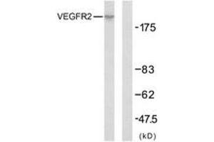 Western Blotting (WB) image for anti-VEGF Receptor 2 (VEGFR2) (AA 917-966) antibody (ABIN2889081) (VEGFR2/CD309 抗体  (AA 917-966))