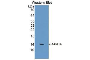 Western blot analysis of the recombinant protein. (S100A12 抗体  (AA 2-92))