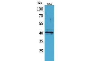 Western Blotting (WB) image for anti-Chemokine (C-C Motif) Receptor 3 (CCR3) (N-Term) antibody (ABIN3178319) (CCR3 抗体  (N-Term))