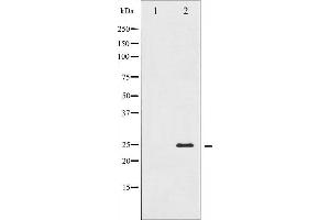 Western blot analysis of TNNI3 expression in Jurkat whole cell lysates,The lane on the left is treated with the antigen-specific peptide. (TNNI3 抗体  (N-Term))