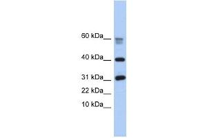 LOC339047 antibody used at 1 ug/ml to detect target protein. (LOC339047 抗体  (Middle Region))