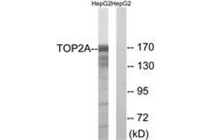 Western blot analysis of extracts from HepG2 cells, using TOP2A (Ab-1343) Antibody. (Topoisomerase II alpha 抗体  (AA 1311-1360))