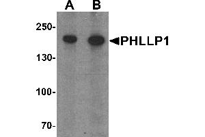 Western blot analysis of PHLPP1 in SW480 cell lysate with PHLPP1 antibody at (A) 1 and (B) 2 µg/mL. (PHLPP1 抗体  (N-Term))