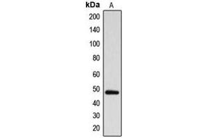 Western blot analysis of ARRDC1 expression in MDAMB231 (A) whole cell lysates. (ARRDC1 抗体  (Center))