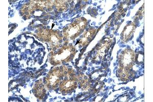 SP140 antibody was used for immunohistochemistry at a concentration of 4-8 ug/ml. (SP140 抗体  (N-Term))