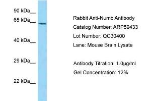 Western Blotting (WB) image for anti-Numb Homolog (NUMB) (C-Term) antibody (ABIN2788064) (NUMB 抗体  (C-Term))
