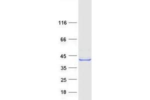 HSDL1 Protein (Myc-DYKDDDDK Tag)