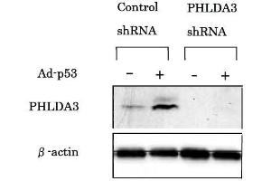Western Blotting (WB) image for anti-Pleckstrin Homology-Like Domain, Family A, Member 3 (PHLDA3) (AA 1-31), (N-Term) antibody (ABIN2452076) (PHLDA3 抗体  (N-Term))