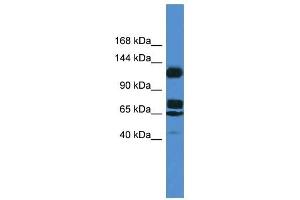 Western Blot showing ST5 antibody used at a concentration of 1. (ST5 抗体  (Middle Region))