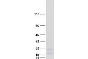 Western Blotting (WB) image for Ring Finger Protein 122 (RNF122) protein (Myc-DYKDDDDK Tag) (ABIN2731017)