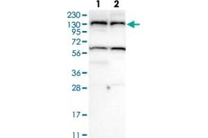 Western Blot analysis of (1) Human RT-4 cell, (2) Human U-251MG sp cell. (USP25 抗体)