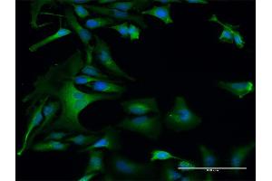 Immunofluorescence of purified MaxPab antibody to DAP3 on HeLa cell. (DAP3 抗体  (AA 1-398))