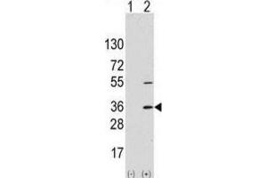 Western Blotting (WB) image for anti-Signal Sequence Receptor, alpha (SSR1) antibody (ABIN2997994) (SSR1 抗体)