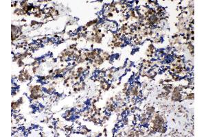 IHC analysis of Musashi 1/Msi1 using anti- Musashi 1/Msi1 antibody . (MSI1 抗体  (N-Term))