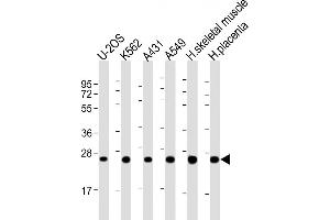 All lanes : Anti-UQCRFS1P1 Antibody (Center) at 1:2000 dilution Lane 1: U-2OS whole cell lysate Lane 2: K562 whole cell lysate Lane 3: A431 whole cell lysate Lane 4: A549 whole cell lysate Lane 5: human skeletal muscle lysate Lane 6: human placenta lysate Lysates/proteins at 20 μg per lane. (UQCRFS1P1 抗体  (AA 71-104))
