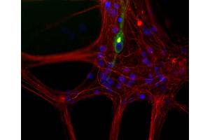 Mixed neuron/glia cultures from newborn rat brain stained with MCA-7C5 antibody to peripherin (green) and rabbit polyclonal antibody to NF-L ABIN1842266 (red channel). (NEFL 抗体)