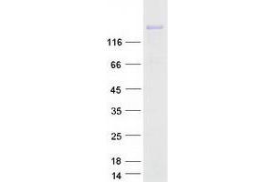 Western Blotting (WB) image for Collagen, Type III, alpha 1 (COL3A1) protein (Myc-DYKDDDDK Tag) (ABIN2712424)